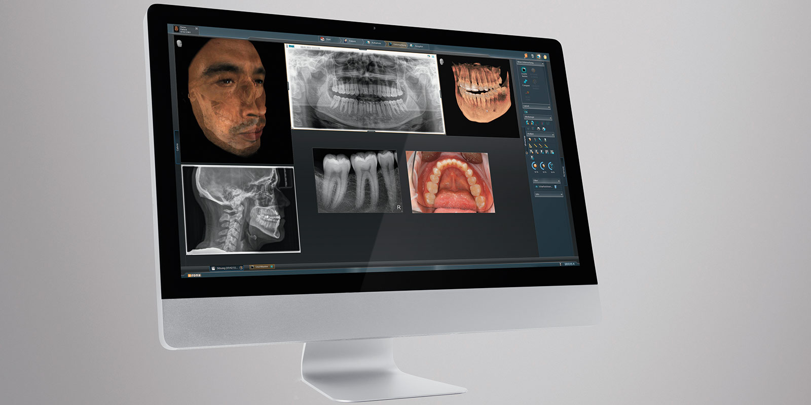 3D-Implantatnavigation – Zahnarzt Kassel, Oralchirurg